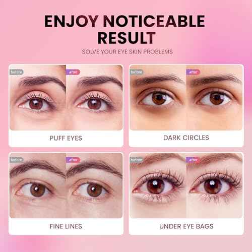 Under Eye Patches (48 Pairs) - New Tri-color Glitter Eye Gel Pads for Dark Circles Puffy Eyes,Under eye Bags,Wrinkles|Natural Collagen Under Eye Mask Patches, Gel Under Eye Patches