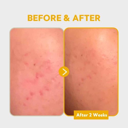 TIRTIR Pure Vitamin C 24% Serum 30ml + SOS Serum 50ml