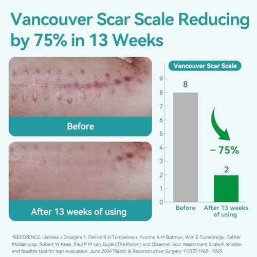 Dimora Medical Grade Silicone Scar Sheets -Ultra Soft Silicone Scar Tape (1.6¡±x60" Roll), Hypoallergenic Scar Removal Treatment for Surgical Scars, C Section, Tummy Tuck, Keloid Treatment