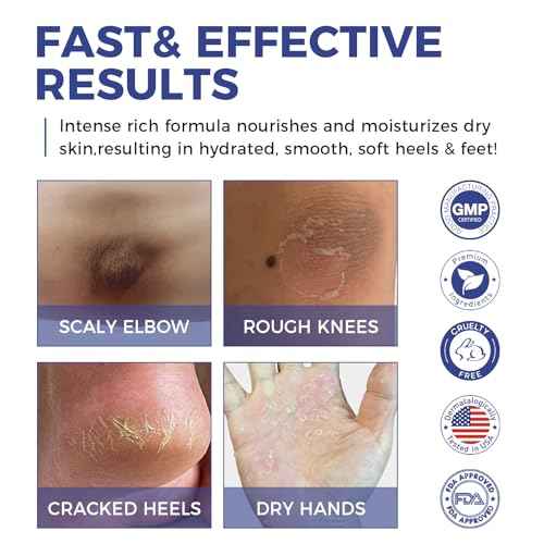 OUKEYA Urea Cream 42% plus Salicylic Acid 2% Intensive Repair Treatment for Cracked Skin on Hands, Heels, Elbows, and Lips - Relief for Dry Feet - Enhanced Pump Dispenser Packaging - Gross wt 8.03 OZ