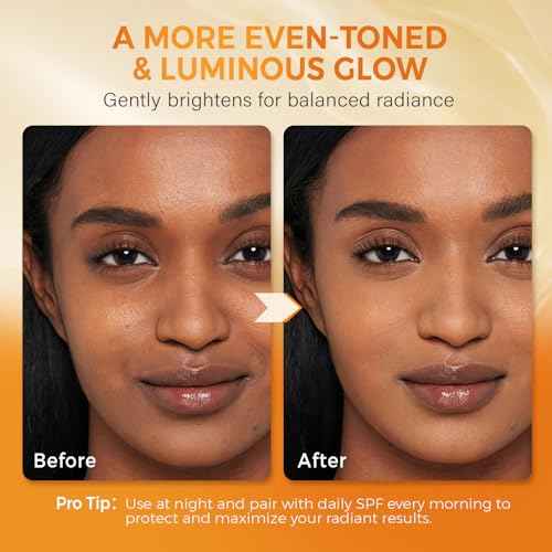 Turmeric Kojic Acid Soap for Dark Spots Brightening ? Facial Cleansing Bar with Vitamin C, Retinol, Collagen, Vitamin E, Glycerin, Shea Butter & Castile Olive Oil ? Soap for Women & Men (120g x 2)
