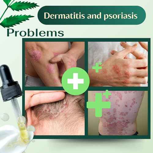 ABERA Alan Silver Serum ? Botanical Hydrating Serum for Dry & Sensitive Skin & Herbal Extracts ? Daily Moisturizer for Face, Body & Scalp ? Fast Absorbing, Lightweight ? 3 boxes
