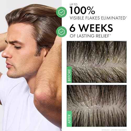Dercos Dandruff Shampoo, Antifungal Dry Scalp Treatment & Itchy Scalp Relief, Prescription Strength Selenium Sulfide Comparable to 2% Ketoconazole, For Mild to Severe Dandruff & Flaky Scalps