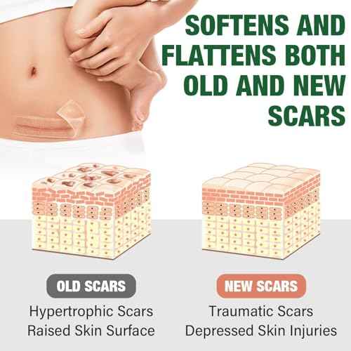 Silicone Scar Sheets,Silicone Scar Tape,Silicone Sheets For Scars,Scar Tape For Surgical Scars,Keloid Bump Removal,Scar Removal For Surgical(1.6"x 120" Roll-3M)