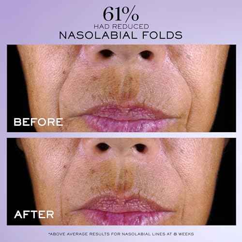 Lanc?me R?nergie C.R.x. Triple Serum Retinol - Anti-Aging Serum With Pure Retinol, Pure Vitamin C, X-Peptide - Target Wrinkles and Pores - All Skin Types, including Sensitive