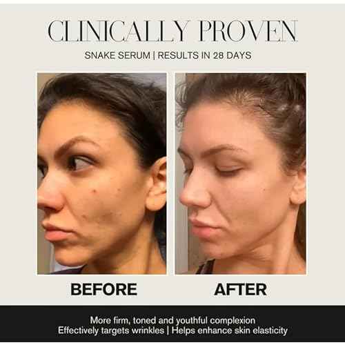 Intoxicated Cosmetics Snake Serum with SYN-AKE¢ç Anti Wrinkle Complex - Reduces Fine Lines and Wrinkles - Hydrating Anti Aging Formula Face Serum - 1 fl oz