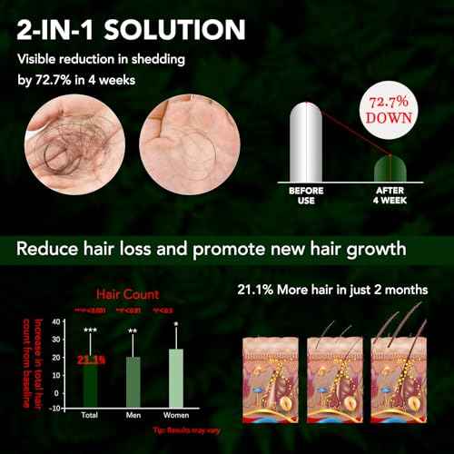 Minoxidil Hair Growth Spray for Men & Women, 5% Minoxidil Topical Solution Hair and Beard Growth Serum, Advanced Hair Regrowth Oil Treatment for Hair Loss, Thinning, Hair Regrowth & Thicker 2.02 fl.oz