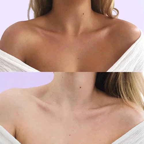 Australian Glow 1 Hour Express Self Tanning Mousse w/Quad-Collagen Complex & Hyaluronic Acid, DARK - 6.76 fl. oz / 200ml