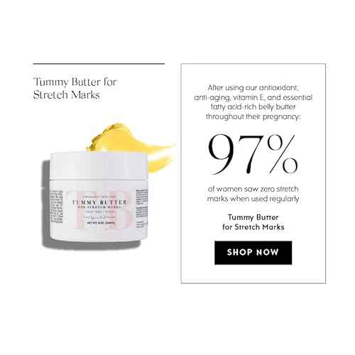 The Spoiled Mama Tummy Butter Stretch Mark Prevention Cream | Safe for Pregnancy | Non-Toxic | Vegan | Made in USA | OBGYN Formulated | Hydrating Body Cream Butter Lotion