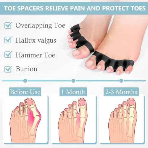 2PCS Toe Separators for Women and Men, Gel Toe Spacers for Pedicure and Foot Alignment, Comfortable Foot Care for Bunions and Overlapping Toes