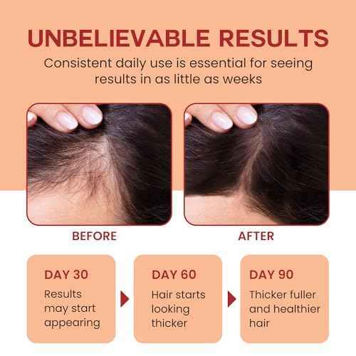 Raw Batana Oil for Hair Growth - 100% Pure, Organic 4oz Batana from Honduras for Thick and Strong Natural Hair - Dr. Sebi Unrefined Cold Pressed Cosmetic Scalp Mask for Men & Women (3 Pack)