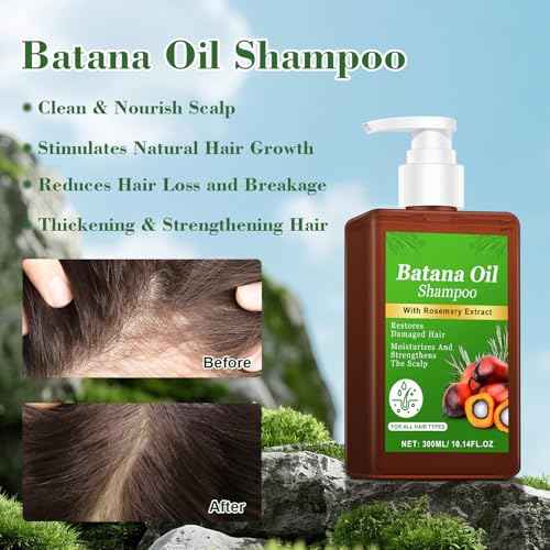-Promote Hair Growth,Rosemary Shampoo,Nourishes Scalp, Reduces Breakage & Adds Shine,Reduces Hair Loss (Batana Shampoo-(10.1 fl oz))