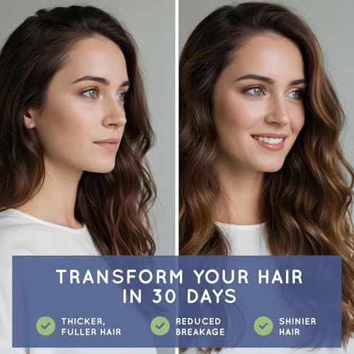 Essential Source Biotin (Biotina Vitaminas) - Hair Skin Nails Vitamins for Women & Men - 5000 mcg - Hair Growth Support Supplements - 90 Tablets - with Revytalyz 5, Vitamin A, C, B12 - Made in USA