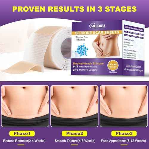 Silicone Scar Sheets, Silicone Scar Tape, Scar Tape for Keloid Bump Removal, Reusable Silicone Scar Strip for C-Section, Keloid, Surgery, Burns, Acne Scar et(1.8¡±x157¡±Roll-4M)