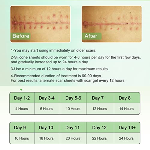 Silicone Scar Sheets (1.6¡± x 120¡± Roll-3M), Silicone Scar Tape Roll, Scar Silicone Strips, Reusable, Professional Scar Removal Sheets for C-Section, Surgery, Burn, Keloid, Acne et