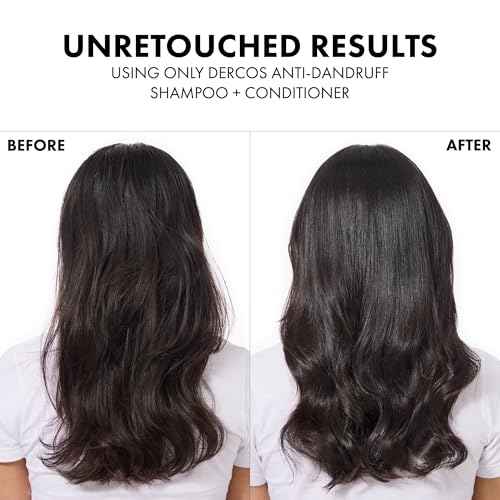 Dercos Hair & Scalp Moisturizing Conditioner, Formulated With Glycerin, Niacinamide + Hyaluronic Acid, Hair Conditioner & Scalp Moisturizer, Strengthens, Post Dandruff Treatment, 6.7 Fl Oz