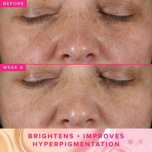 Farmacy 3% TXA Toner for Face - Brightening Face Toner for Oily Skin - Liquid Exfoliant with Azelaic Acid + 5% PHA to Target Visible Dullness + Help Reduce Uneven Skin Tone (50ml)