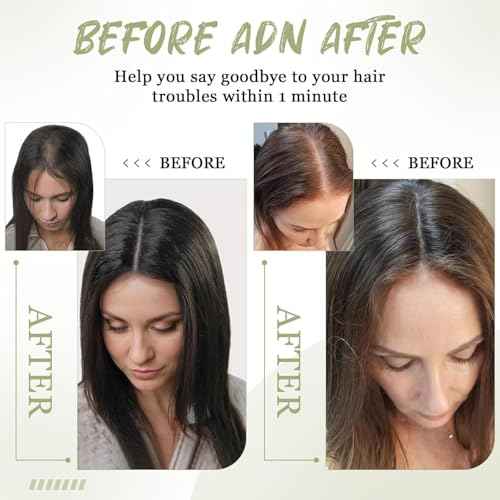 Urbeauty Hair Toppers for Women Real Human Hair for Thinning, 16 inch 1.5¡±x5¡±Silk Base Upgrade Topper, Clip-in Volume Enhancer, Natural-Looking, No Glue, Breathable, Lightweight