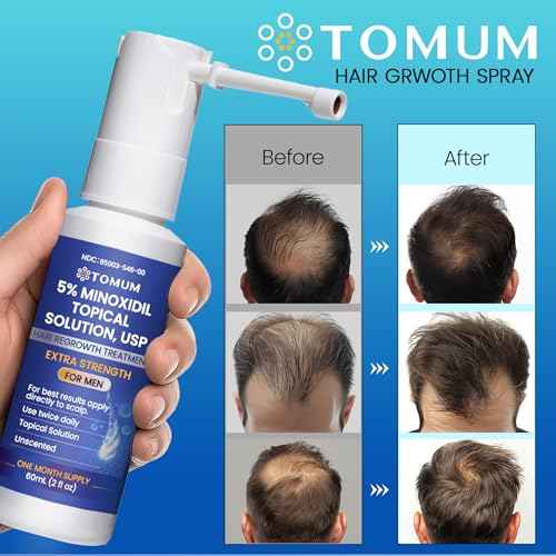 Men's 5% Minoxidil Hair Growth: Extra Strength Minoxidil Spray Hair Regrowth Treatment Serum Stop Hair Thinning and Hair Loss For Stronger Thicker Longer Hair Made in USA 60ml