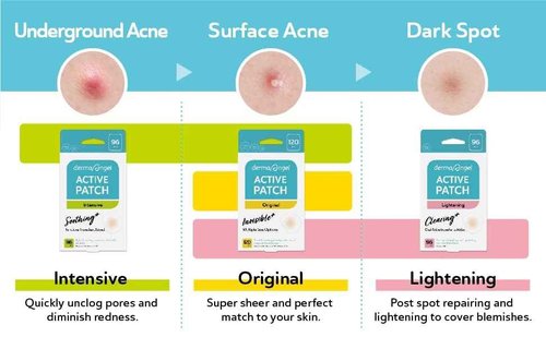 DERMA ANGEL Dark Spot Patches Blemish Patches with Hydrocolloid, TXA & CICA for Active Acne & Post-Inflammatory Dark Spots - Day and Night Use - UPGRADED (Post Acne - 96 Count - 1 Size)