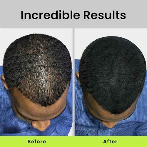 ECLIPSE Hair Fibers Medium Brown for Thinning Hair for Women & Men to Conceal Hair Loss in 15 Seconds - 100% Undetectable Hair Building Fibers, 60g