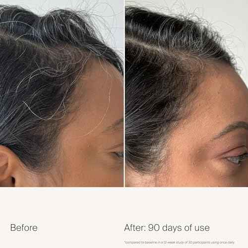 Living Proof Scalp Care Density Serum