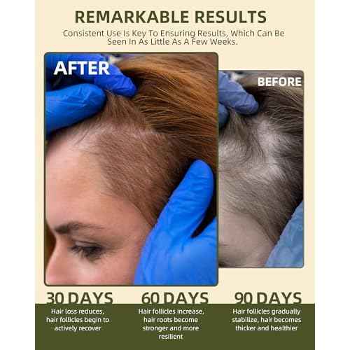 100% Natural Raw Batana Oil for Hair Growth, Dr Sebi Hair Growth Oil From Honduras, Thicker & Stronger Hair, Prevents Hair Loss, Eliminates Split Ends 4.23 Fl Oz (Pack of 1)