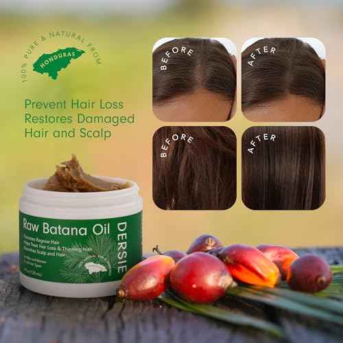 Dersie Batana Oil for Hair Growth: Unrefined Raw Batana Oil Sourced from Honduras ? 100% Pure & Organic for Thicker & Stronger Hair - Works as Hair Mask for Deep Conditioning & Repair (4 oz)