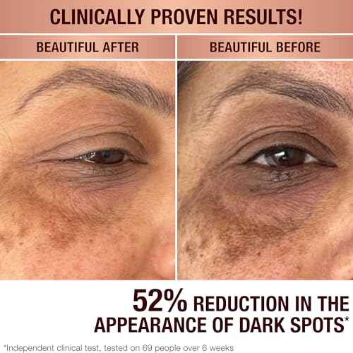 Charlotte Tilbury Radiance Recovery Dark Spot Serum - Dark Spot Corrector & Vitamin C Serum for a Brighter-Looking Complexion - Helps Reduce the Appearance of Redness & Uneven Skin Tone