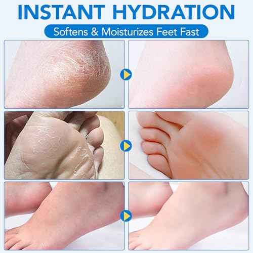2Pack Urea Cream 60% plus Salicylic Acid 2% Urea Foot Care Stick,Foot Cream for Foot Callus Remover, Feet Moisturizer Stick for Dry Cracked Heels, Hands, Knees,Hydrating Heel Balm, Easy To Use