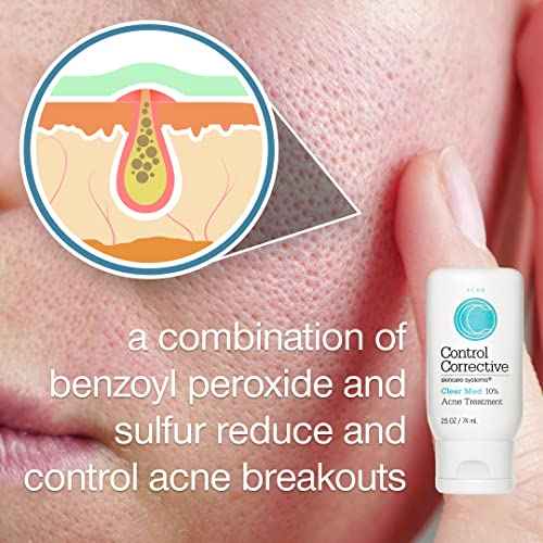 CONTROL CORRECTIVE Clear Med 10% Acne Treatment Lotion, 2.5 Oz - Helps Clear & Control Breakouts, Benzoyl Peroxide, 3% Sulfur To Improve Efficacy And Dry Up Blemishes
