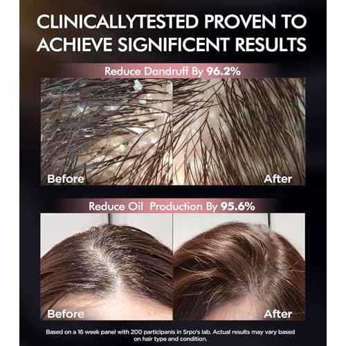 Dual Essence Hair Growth Shampoo and Conditioner Set with Biotin&Tripeptide, 3X Moisturizing Biotin Shampoo for Softer Shiner Hair, Anti-Loss Dandruff Routine Rosemary Shampoo for Men Women, 2x16.9oz