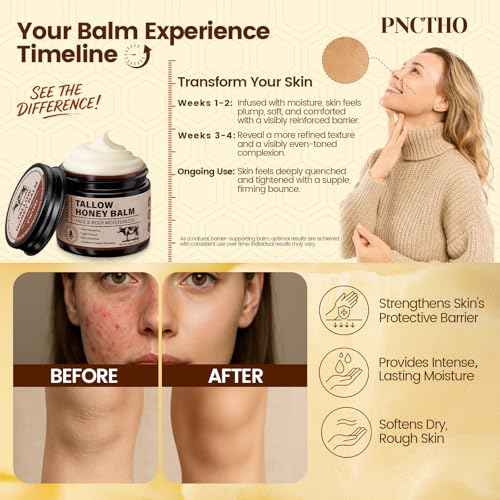 Beef Tallow for Skin, Tallow and Honey Balm with 100% Grass-Fed Beef Tallow & Raw Wild Honey, Natural Face & Body Moisturizer for Deep Hydration, Barrier Repair, Soothing Relief 2.1 OZ
