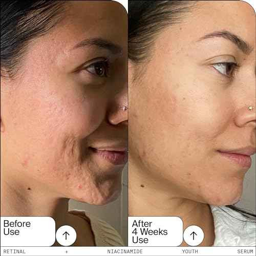 Youth To The People Retinal + Niacinamide Youth Face Serum - Retinal Night Serum for Textured + Blemished Skin, Reduces Fine Lines, Brightens Uneven Tone with Niacinamide, Fragrance-free - 1 fl oz