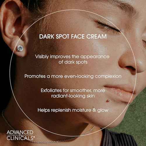 Advanced Clinicals Dark Spot Face Moisturizer | Lactic Acid Lotion For Face With Caffeine, Cocoa Butter, & Vitamin A | Brightening Cream Visibly Reduces Look Of Dark Spots & Uneven Skin Tone, 2 Fl Oz