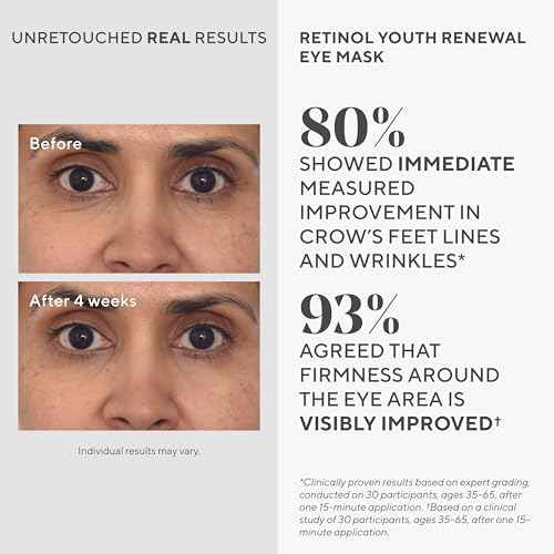 Murad Retinol Youth Renewal Eye Masks ? No-Slip Full Absorption Bio-Cellulose Under Eye Patches with Retinol, Blue Agave, & Passionfruit for Lines, Wrinkles, Puffiness