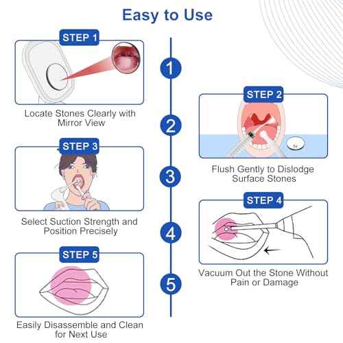 Tonsil Stone Vacuum Remover with LED Light Upgraded Electronic Oral Care Cleaning Tool Set 6 Suction Levels for Fresh Breath & Comfortable Use (White)
