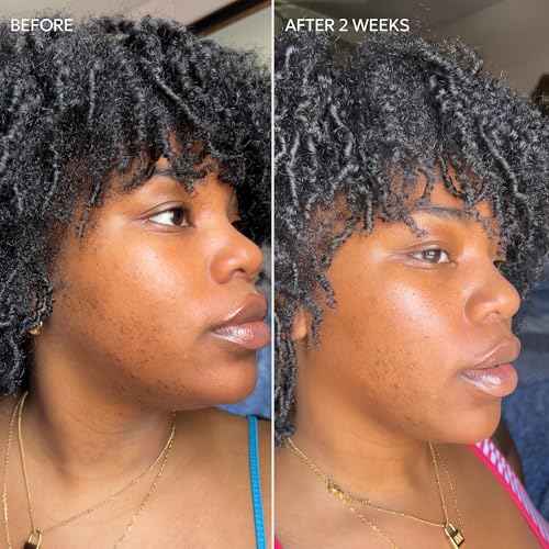Dermisa Skin Fade Cream with Vitamin C | Helps Reduce Dark Spots and Age Spots | All Skin Types | 1.78 OZ | Pack of 1