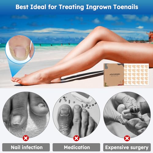 Ingrown Toenail Treatment, No Glue Breathable Curved Toenail Corrector£¬Ingrown Toenail Corrector Strips with File and Lifter, Professional Nail Correction Stickers 60Pcs
