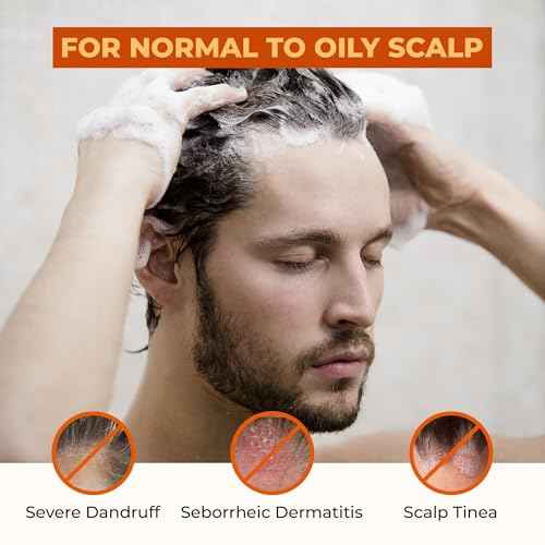 ABERA Anti Dandruff Shampoo for Stronger Hair & Healthier Scalp, Nourishes, Supports and Promotes Hair Growth, Get Rid of Dandruff, Set of 2