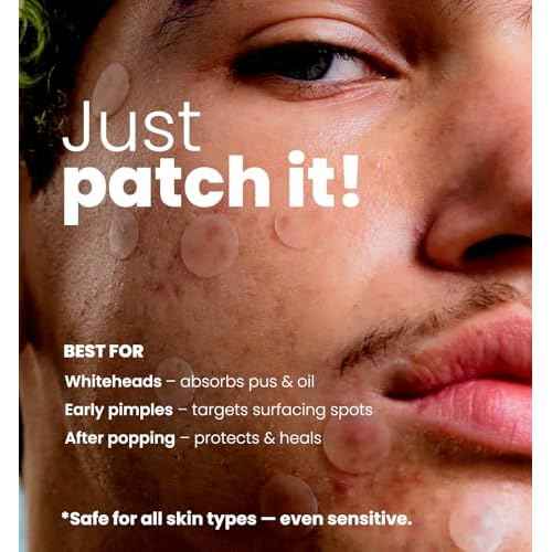 ROSELYNBOUTIQUE Pimple Patches for Face 300 Counts 4 Sizes Hydrocolloid Acne Patches with Tea Tree Oil,Zits Blemishes Pore Strips - Vegan Facial Skin Care Products Cruelty-Free