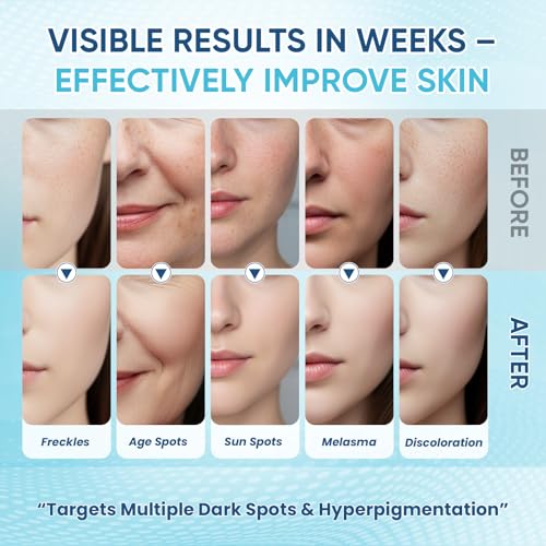Dark Spot Remover for Face Body Serum with Hyperpigmentation Treatment Skin Brown Spot Age Spot Remover Dark Spot Corrector Glow Serum Brighten Even Gentle and Non-Irritating Unisex 1 Fl Oz 2 pack