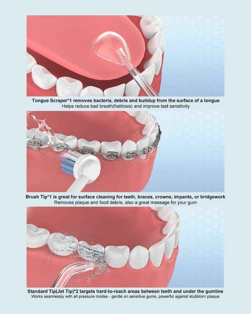 Water Dental Flosser, 300ML Cordless Oral Irrigator Rechargeable Dental Flosser Picks with 9 Levels 5 Jet Tips,IPX7 Waterproof Teeth Cleaner for Braces Gum Care (White)