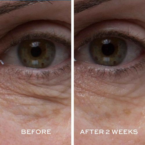 ELEMIS Peptide4 Eye Recovery Cream, Reviving Eye Cream, 0.5 Fl Oz