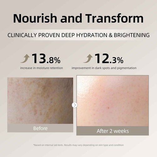 DEEOM Real Yam Brightening Toner, Hydrating Milky Toner for Face with Rice Water, Yam Extract & Niacinamide, Korean Moisturizing Facial Toner, Alcohol Free, Glow Enhancing, 300ml