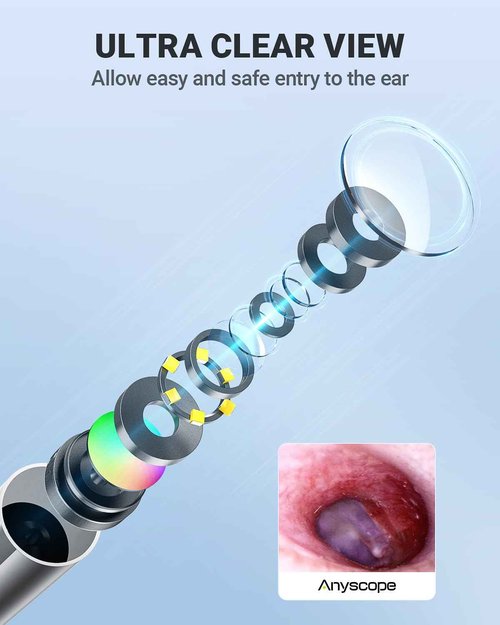 AnyScope Wireless Otoscope with Gyroscope, Ear Camera with Dual View, 3.9 mm Otoscope with Light, Ear Scope with Ear Wax Removal Tool for Kids, Adults, and Pets, Compatible with iPhone and Android