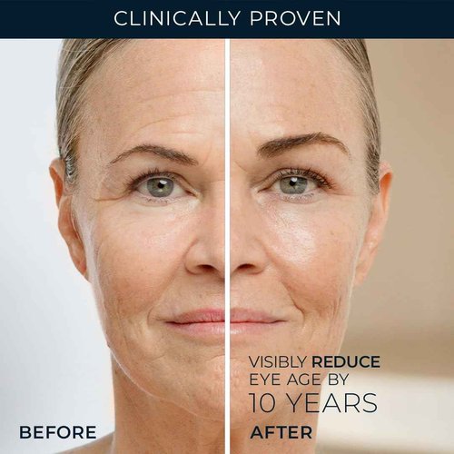RoC Retinol Correxion Under Eye Cream for Dark Circles & Puffiness, Daily Wrinkle Cream, Anti Aging Skin Care Treatment Women and Men, 0.5 oz (Packaging May Vary)