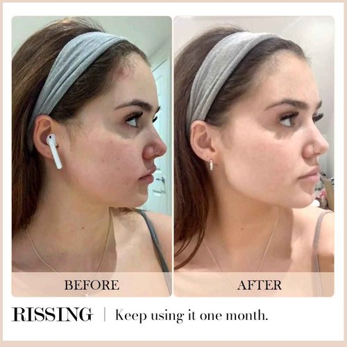 RISSING 4-in-1 Gua Sha Facial Tools: Lymphatic Drainage Massager Facial Roller for Wrinkles and Lifting, Stainless Steel Gua Sha Tool for Face (Portable Box Edition)