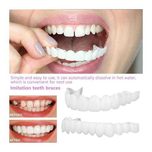 2 Pairs, Nature and Comfortable Top and Bottom, Regain Confidence Smile for Men and Women (1)