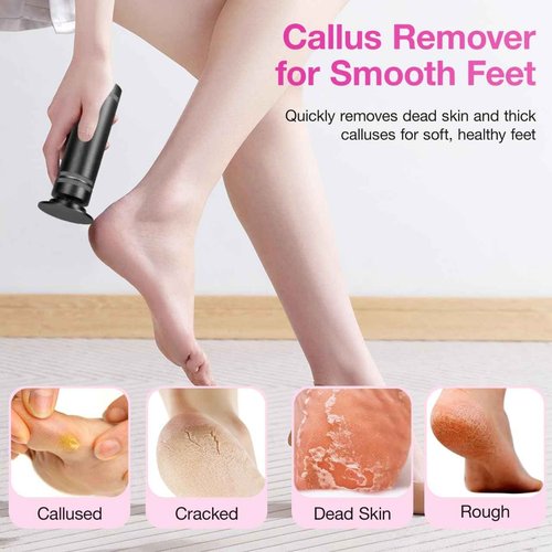 Hocent Upgrade 1200RPM Electric Callus Remover for Feet, Powerful Electric Foot File with 60 Sandpaper Discs, Adjustable Speed, Plug-in Pedicure Tool for Cracked Heels & Dead Skin, Black